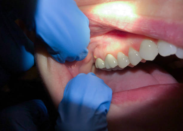 Professional Emergency Dentist in AK